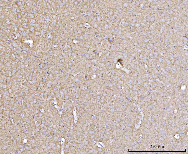 2 - Anti-Drebrin/DBN1 Antibody Picoband™ (monoclonal, 4F6E7) ABO16566