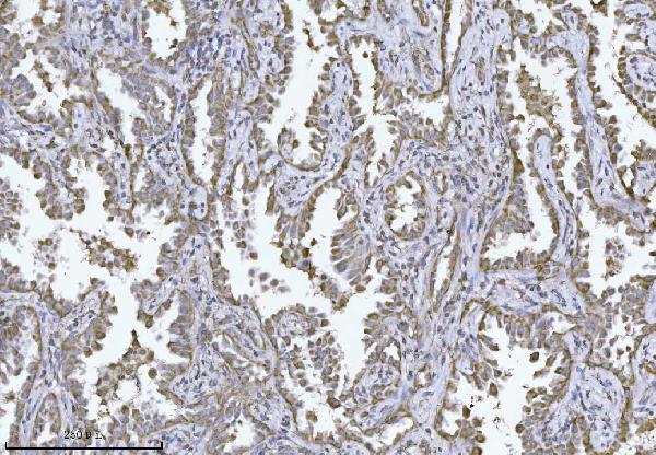 2 - Anti-MPPB/PMPCB Antibody Picoband™ (monoclonal, 9F13E4) ABO16567