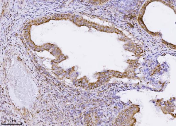 2 - Anti-MPPB/PMPCB Antibody Picoband™ (monoclonal, 9F13E4) ABO16567