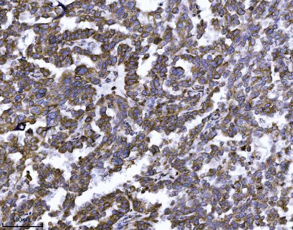 2 - Anti-Erlin-2/ERLIN2 Antibody Picoband™ (monoclonal, 3H9A2) ABO16568