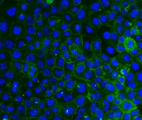 2 - Anti-Integrin beta 4/ITGB4 Antibody Picoband™ (monoclonal, 7G10D2) ABO16569