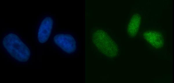 3 - Anti-MCM7 Antibody Picoband™ (monoclonal, 3H11) ABO16570