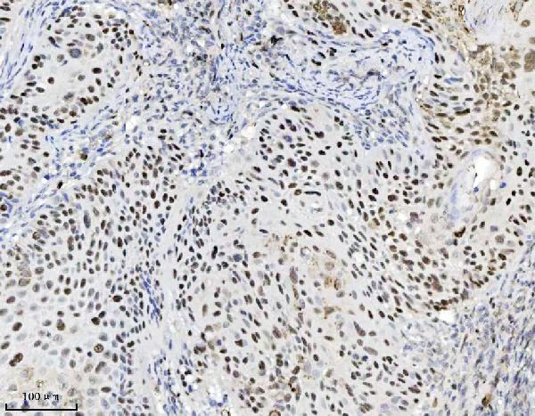 2 - Anti-MCM7 Antibody Picoband™ (monoclonal, 3H11) ABO16570
