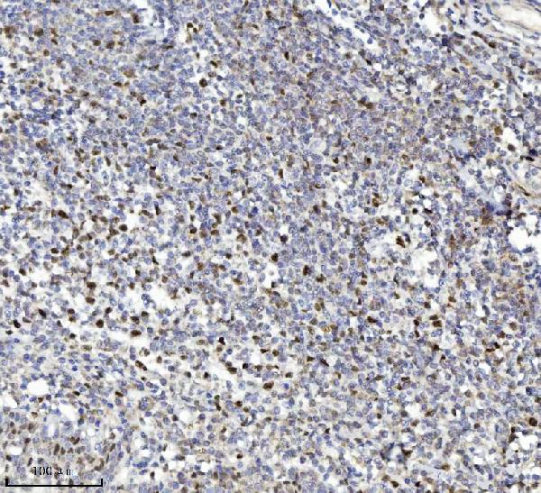 2 - Anti-MCM7 Antibody Picoband™ (monoclonal, 3H11) ABO16570