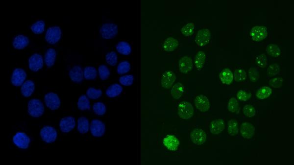 3 - Anti-RCC1 Antibody Picoband™ (monoclonal, 6B11E7) ABO16574