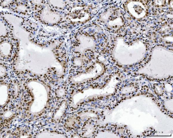 2 - Anti-RCC1 Antibody Picoband™ (monoclonal, 6B11E7) ABO16574
