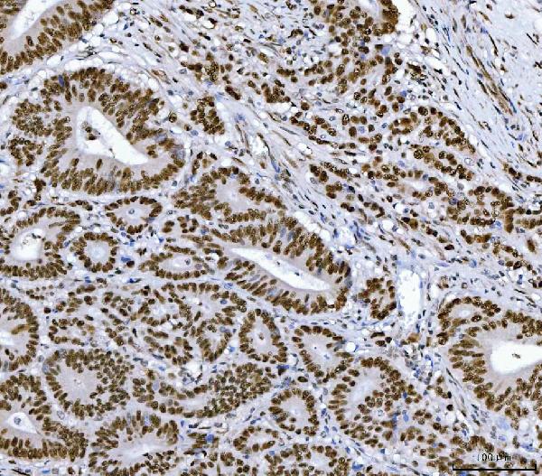 2 - Anti-RCC1 Antibody Picoband™ (monoclonal, 6B11E7) ABO16574