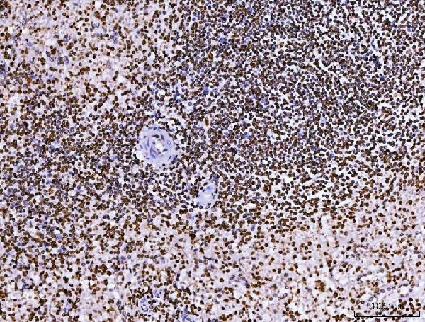 2 - Anti-RCC1 Antibody Picoband™ (monoclonal, 6B11E7) ABO16574