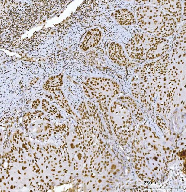 2 - Anti-RCC1 Antibody Picoband™ (monoclonal, 6B11E7) ABO16574