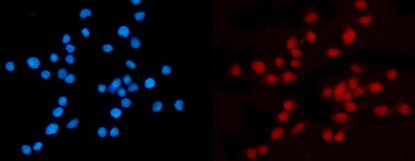 3 - Anti-KPNB1 Antibody Picoband™ (monoclonal, 3I11F2) ABO16576