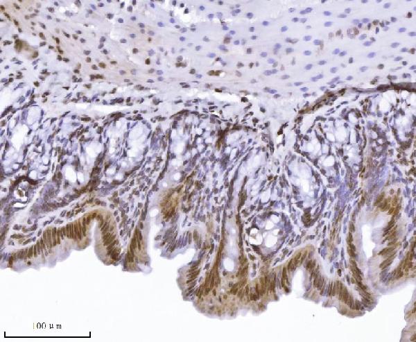 2 - Anti-KPNB1 Antibody Picoband™ (monoclonal, 3I11F2) ABO16576