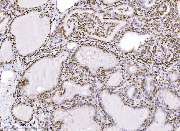 2 - Anti-KPNB1 Antibody Picoband™ (monoclonal, 3I11F2) ABO16576