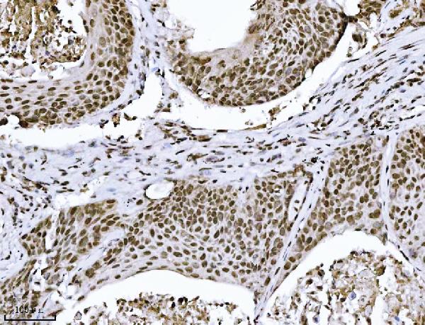 2 - Anti-KPNB1 Antibody Picoband™ (monoclonal, 3I11F2) ABO16576