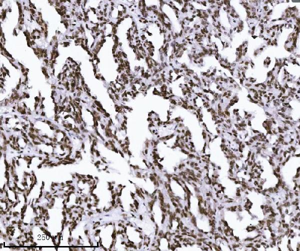 2 - Anti-KPNB1 Antibody Picoband™ (monoclonal, 3I11F2) ABO16576