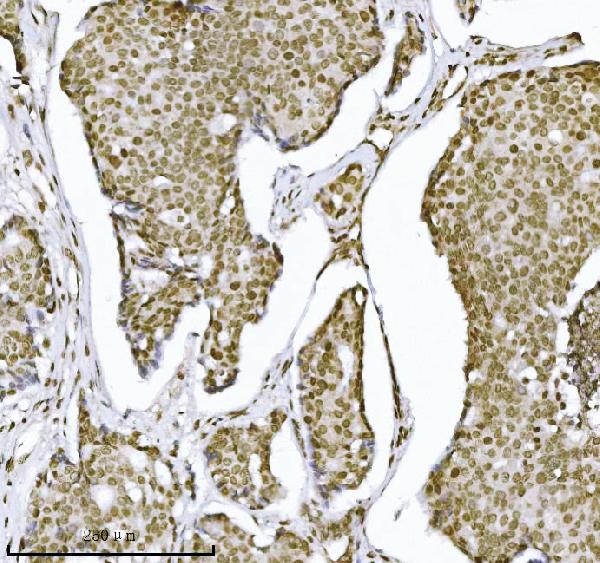2 - Anti-KPNB1 Antibody Picoband™ (monoclonal, 3I11F2) ABO16576