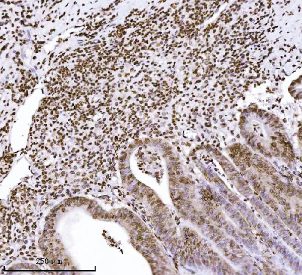 2 - Anti-KPNB1 Antibody Picoband™ (monoclonal, 3I11F2) ABO16576
