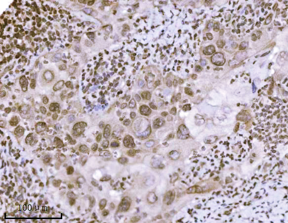 2 - Anti-KPNB1 Antibody Picoband™ (monoclonal, 3I11F2) ABO16576