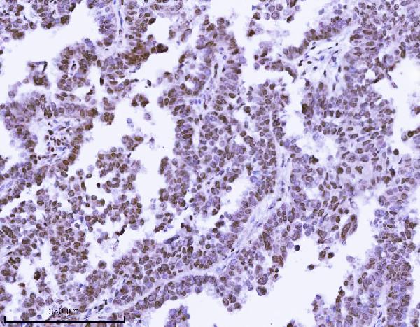 2 - Anti-KPNB1 Antibody Picoband™ (monoclonal, 3I11F2) ABO16576