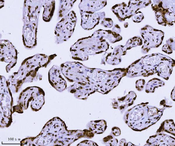 2 - Anti-KPNB1 Antibody Picoband™ (monoclonal, 3I11F2) ABO16576