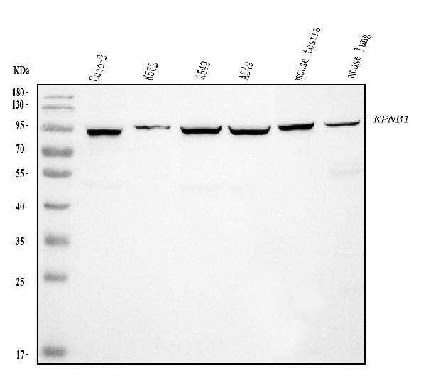 1 - Anti-KPNB1 Antibody Picoband™ (monoclonal, 3I11F2) ABO16576