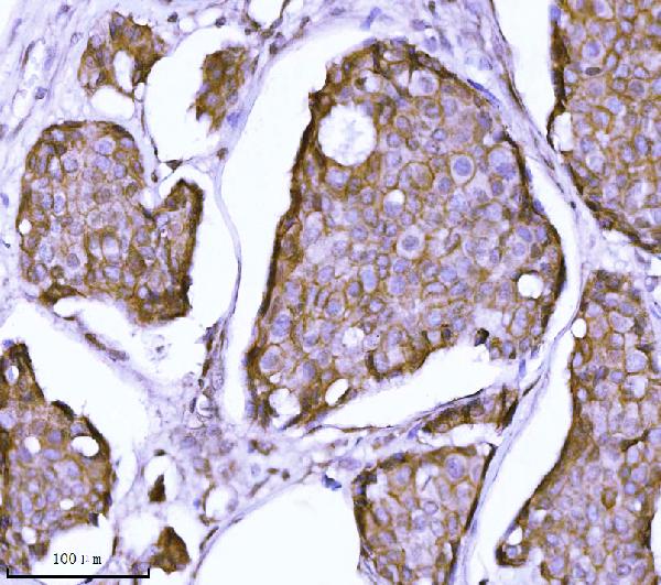 2 - Anti-delta 1 Catenin/CAS/CTNND1 Antibody Picoband™ (monoclonal, 8G7E4) ABO16578