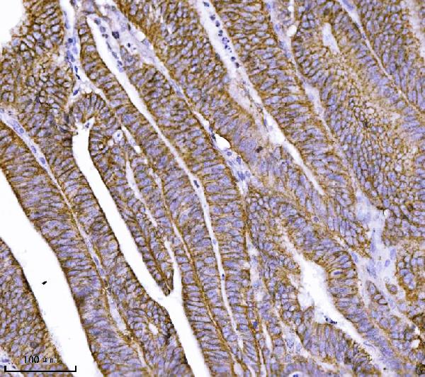 2 - Anti-delta 1 Catenin/CAS/CTNND1 Antibody Picoband™ (monoclonal, 8G7E4) ABO16578