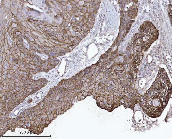 2 - Anti-delta 1 Catenin/CAS/CTNND1 Antibody Picoband™ (monoclonal, 8G7E4) ABO16578
