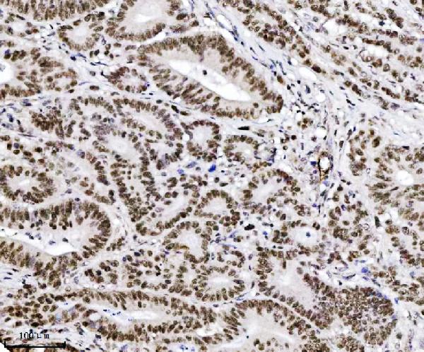 2 - Anti-TRIM24 Antibody Picoband™ (monoclonal, 4G6C2) ABO16579