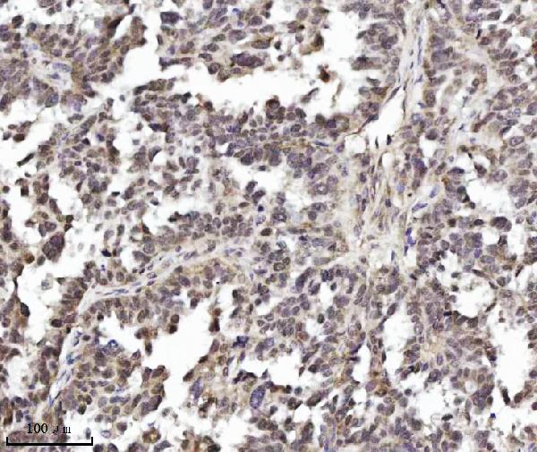 2 - Anti-TRIM24 Antibody Picoband™ (monoclonal, 4G6C2) ABO16579