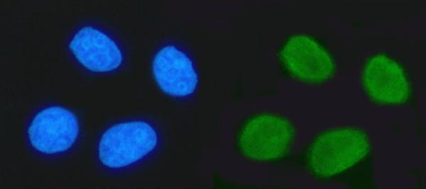 2 - Anti-TRIM24 Antibody Picoband™ (monoclonal, 4G6C2) ABO16579