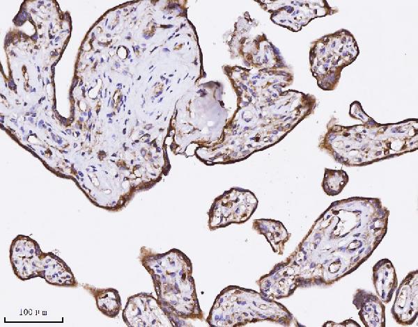 2 - Anti-Annexin A3 Antibody Picoband™ (monoclonal, 2H3H8) ABO16580