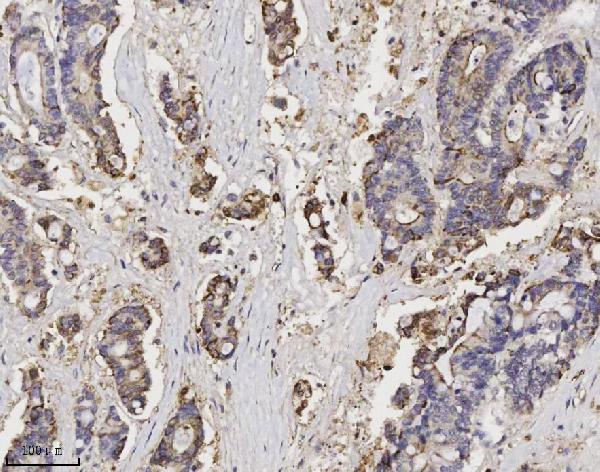 2 - Anti-Annexin A3 Antibody Picoband™ (monoclonal, 2H3H8) ABO16580