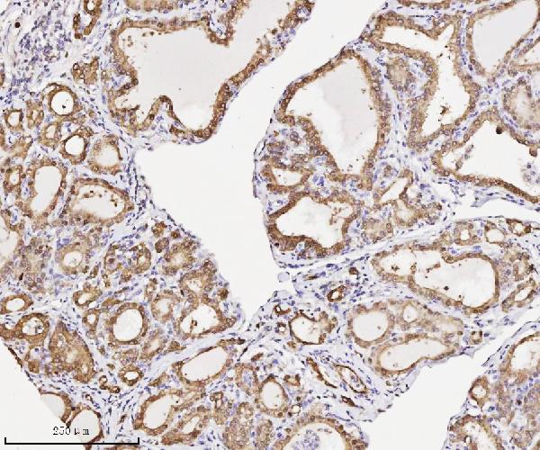 2 - Anti-Annexin A3 Antibody Picoband™ (monoclonal, 2H3H8) ABO16580