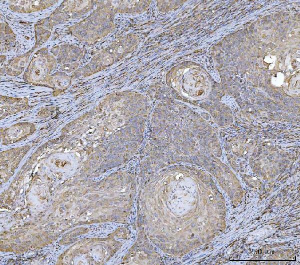 2 - Anti-HLA-DR/HLA-DRA Antibody Picoband™ (monoclonal, 8I10H1) ABO16581