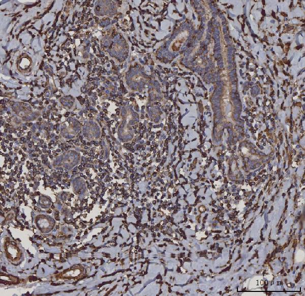 2 - Anti-HLA-DR/HLA-DRA Antibody Picoband™ (monoclonal, 8I10H1) ABO16581