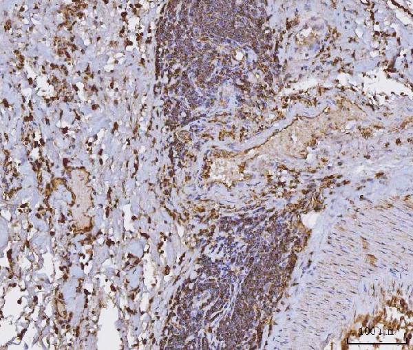 2 - Anti-HLA-DR/HLA-DRA Antibody Picoband™ (monoclonal, 8I10H1) ABO16581