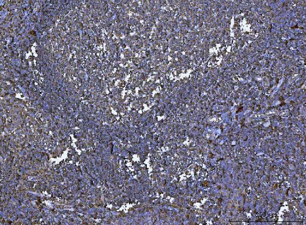2 - Anti-HLA-DR/HLA-DRA Antibody Picoband™ (monoclonal, 8I10H1) ABO16581