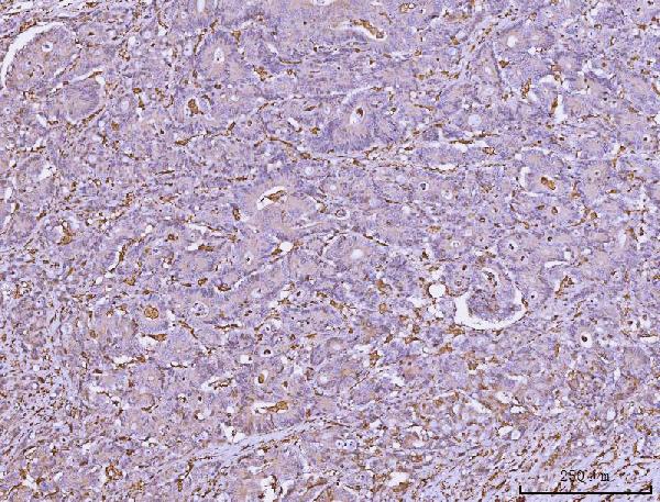 2 - Anti-HLA-DR/HLA-DRA Antibody Picoband™ (monoclonal, 5B13F7) ABO16582