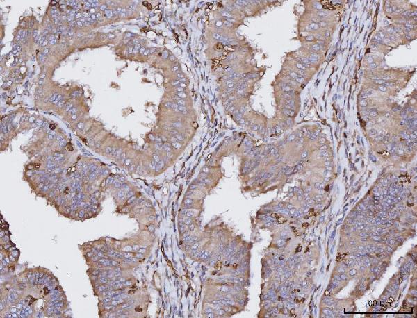 2 - Anti-HLA-DR/HLA-DRA Antibody Picoband™ (monoclonal, 5B13F7) ABO16582