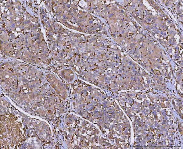 2 - Anti-HLA-DR/HLA-DRA Antibody Picoband™ (monoclonal, 5B13F7) ABO16582
