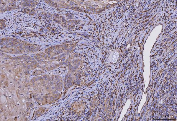 2 - Anti-HLA-DR/HLA-DRA Antibody Picoband™ (monoclonal, 5B13F7) ABO16582