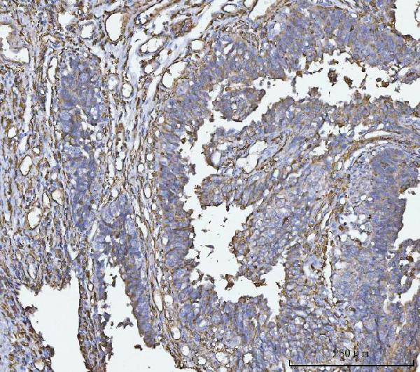 2 - Anti-HLA-DR/HLA-DRA Antibody Picoband™ (monoclonal, 5B13F7) ABO16582