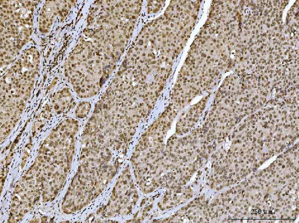 2 - Anti-Ataxin 1 Antibody Picoband™ (monoclonal, 2B13G8) ABO16583