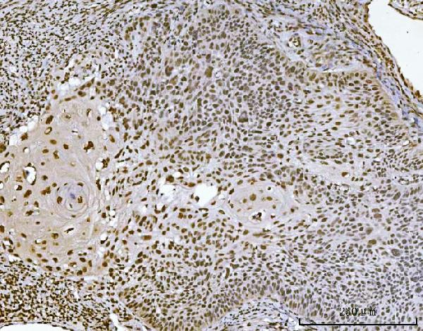2 - Anti-Ataxin 1 Antibody Picoband™ (monoclonal, 2B13G8) ABO16583