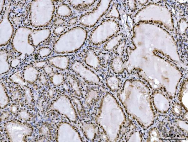 2 - Anti-Ataxin 1 Antibody Picoband™ (monoclonal, 2B13G8) ABO16583