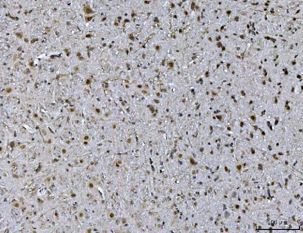 2 - Anti-Ataxin 1 Antibody Picoband™ (monoclonal, 2B13G8) ABO16583
