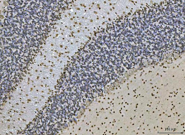 2 - Anti-Ataxin 1 Antibody Picoband™ (monoclonal, 2B13G8) ABO16583