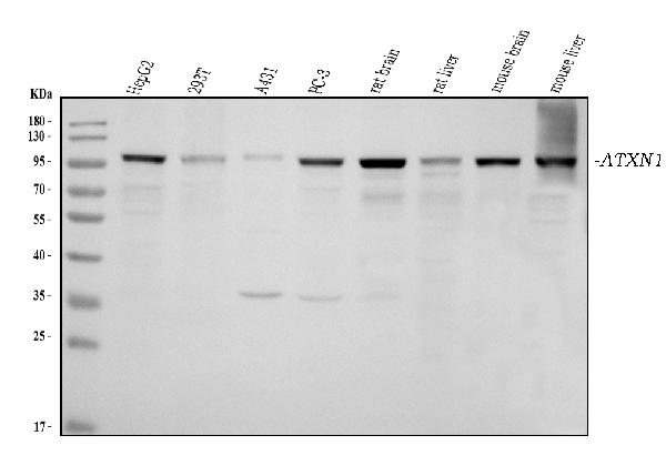 1 - Anti-Ataxin 1 Antibody Picoband™ (monoclonal, 2B13G8) ABO16583