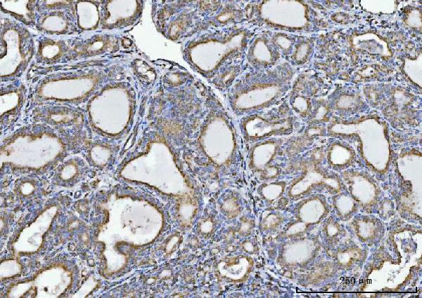 2 - Anti-Glycine decarboxylase/GLDC Antibody Picoband™ (monoclonal, 3D3D3) ABO16585