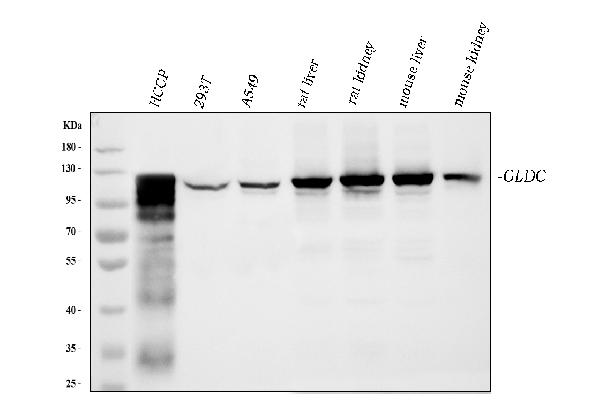 1 - Anti-Glycine decarboxylase/GLDC Antibody Picoband™ (monoclonal, 3D3D3) ABO16585